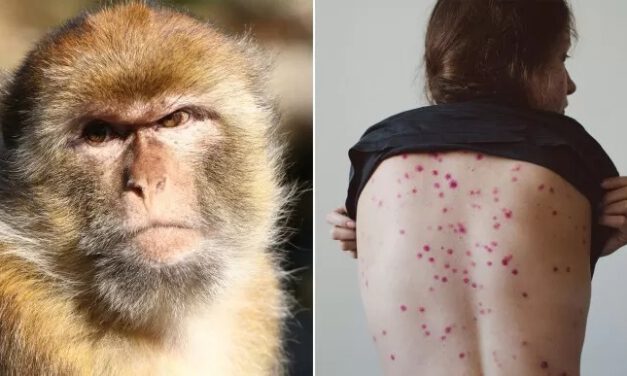 La OMS asegura que el brote de viruela del mono "todavía puede controlarse"