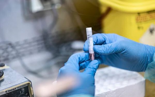 Aumentan a 25 los casos de viruela del mono, con 18 más en investigación