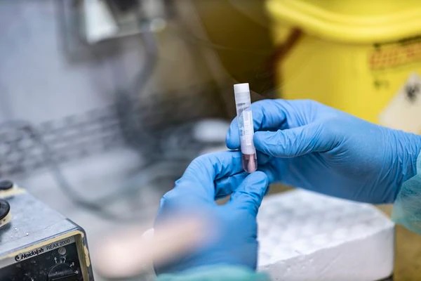 Aumentan a 25 los casos de viruela del mono, con 18 más en investigación