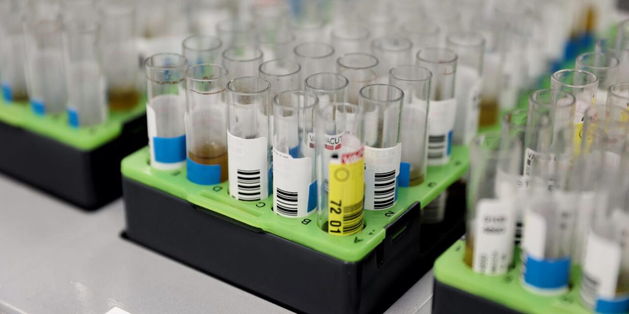 Hallan por primera vez en Europa occidental un parásito que causa meningitis